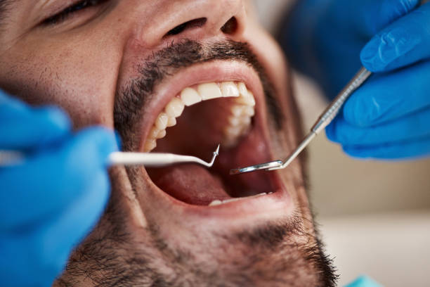 Best Emergency Gum Treatment in Briar Chapel, NC