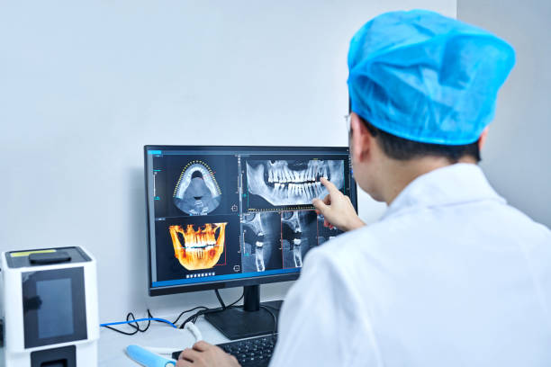 Best Emergency Tooth Extraction in Briar Chapel, NC
