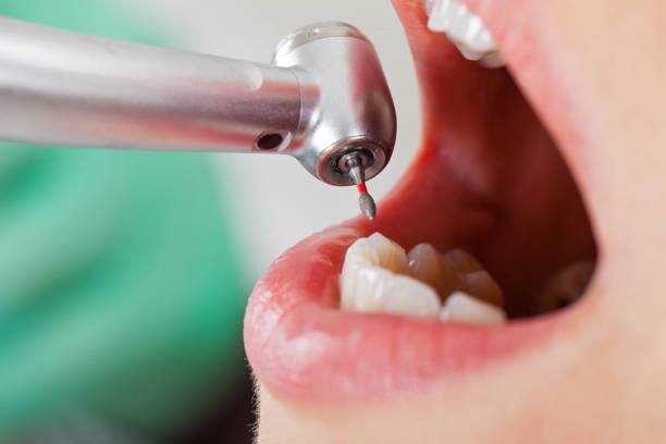 Best Emergency Dental Care for Broken or Chipped Teeth in Briar Chapel, NC